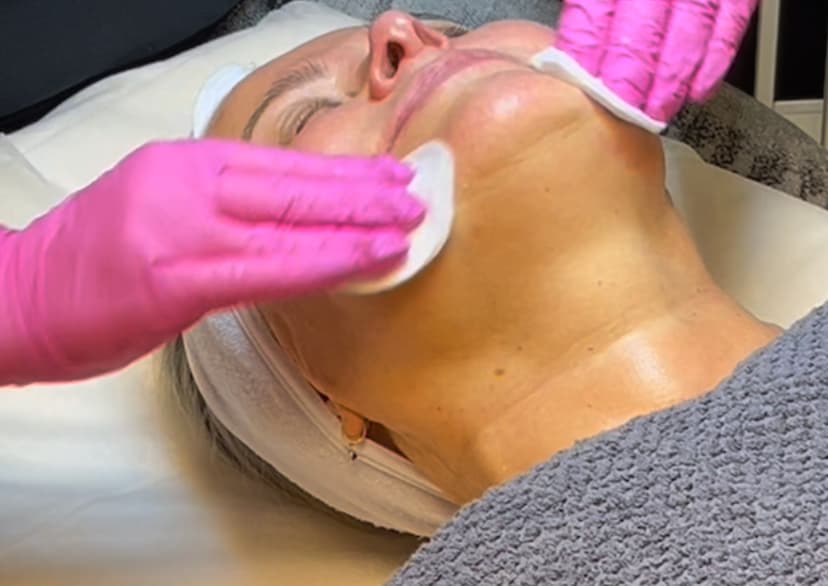 Kemiallinen kuorinta | Järvenpää