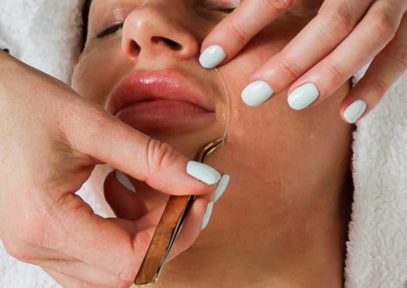 BIOAGE kollageenisilkkilankakohotus nano-mikroneulauksella 4 kertaa | Järvenpää